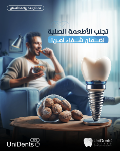 نصائح هامة بعد زراعة الأسنان لضمان نجاح العملية